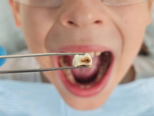 Best Cracked Tooth Emergency Dentist  in Columbus, GA