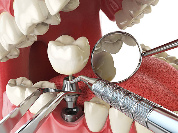 Best Root Canal Emergency Dentist  in Columbus, GA